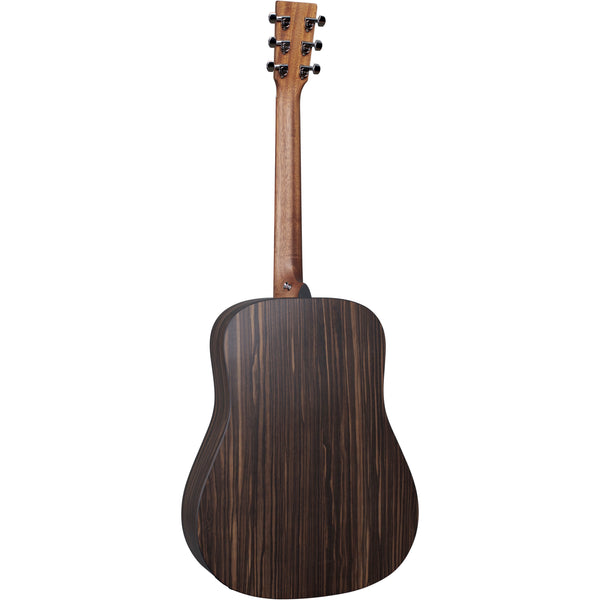 Martin D-X2E Burst X Series Satin Sunburst | Music Experience